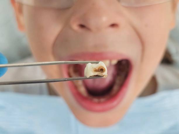 Best Weekend Emergency Dentist in Buffalo Center, IA